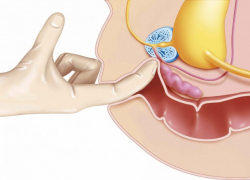 Prostata orgasmer med massage: Komplet guide
